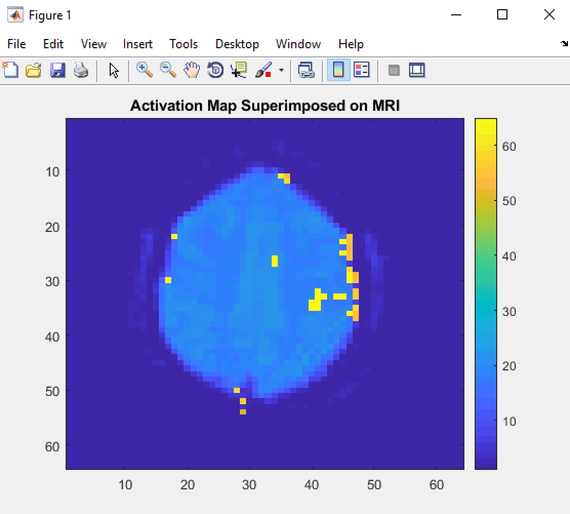 Brain MRI activation map