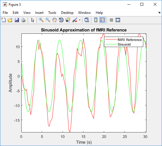 Brain MRI Activation Map